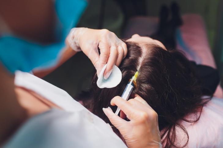 Hyaluronic acid injection to enhance lips